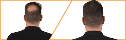 Risultati Prima e Dopo
